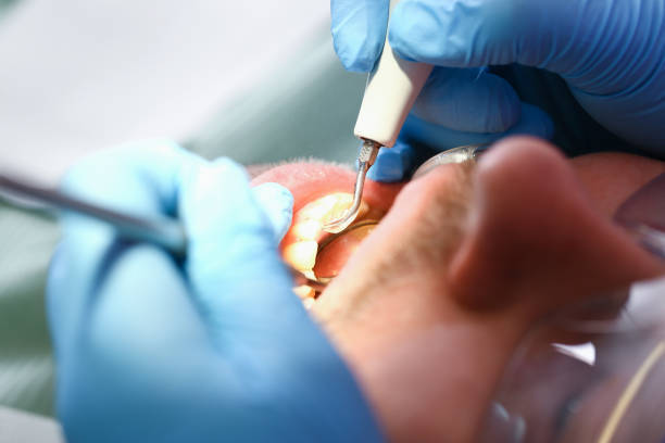 Best Emergency Dental Care for Broken or Chipped Teeth in Ripley, MS